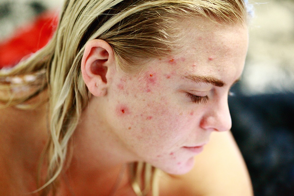 Les problèmes de peau, une panoplie de causes aux simptômes différents